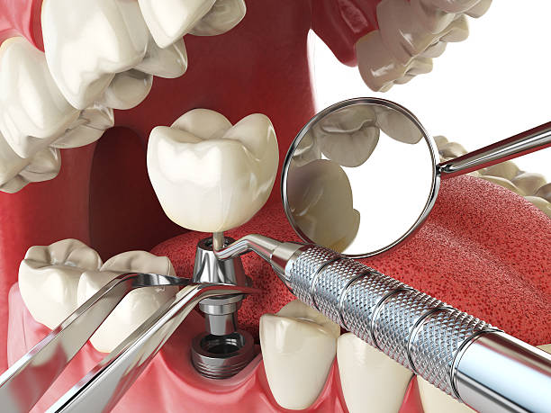 Best Emergency Cosmetic Dentistry (e.g., broken veneers) in Clover, SC