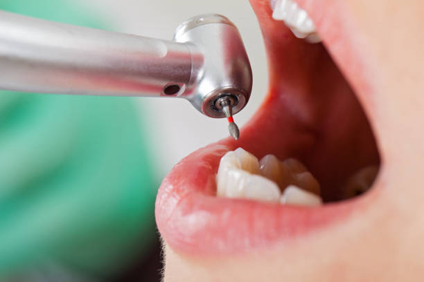 Professional Emergency Dental Service in SC